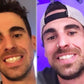 Irresistible Smile | At-Home Teeth Whitening Kit