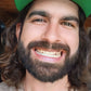 Irresistible Smile | At-Home Teeth Whitening Kit