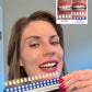 Irresistible Smile | At-Home Teeth Whitening Kit