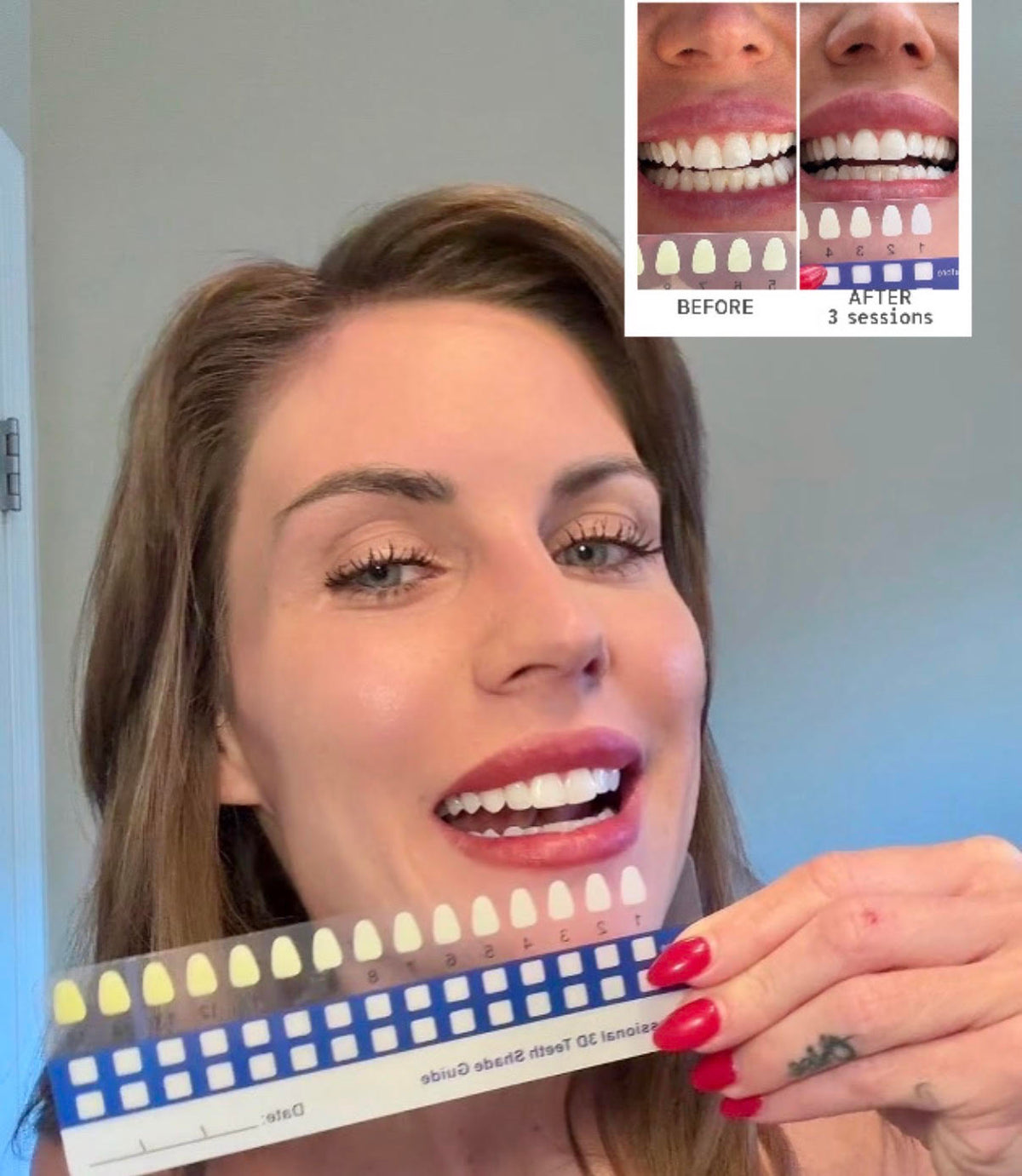 Irresistible Smile | At-Home Teeth Whitening Kit